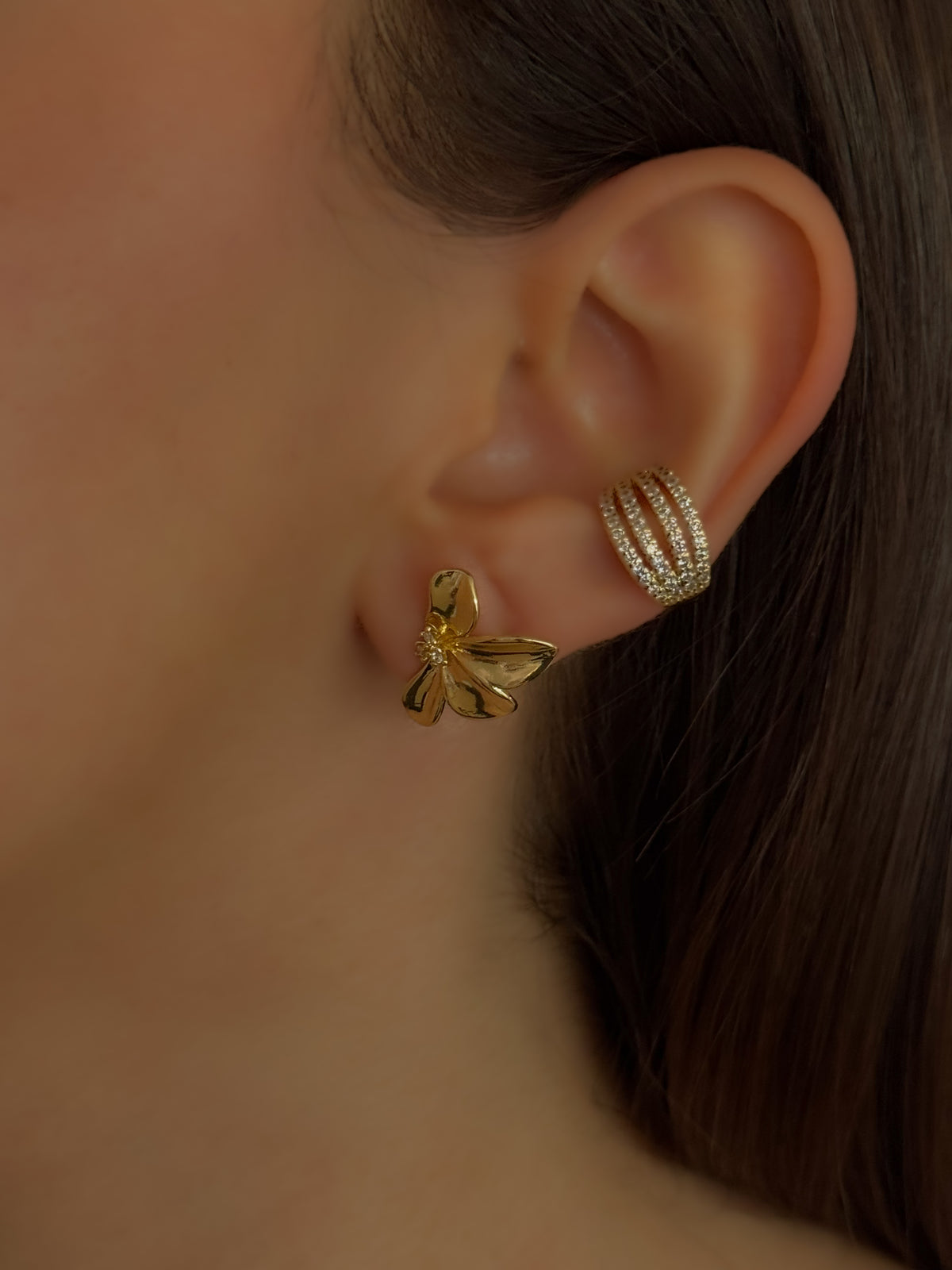 ARETE ANAHÍ