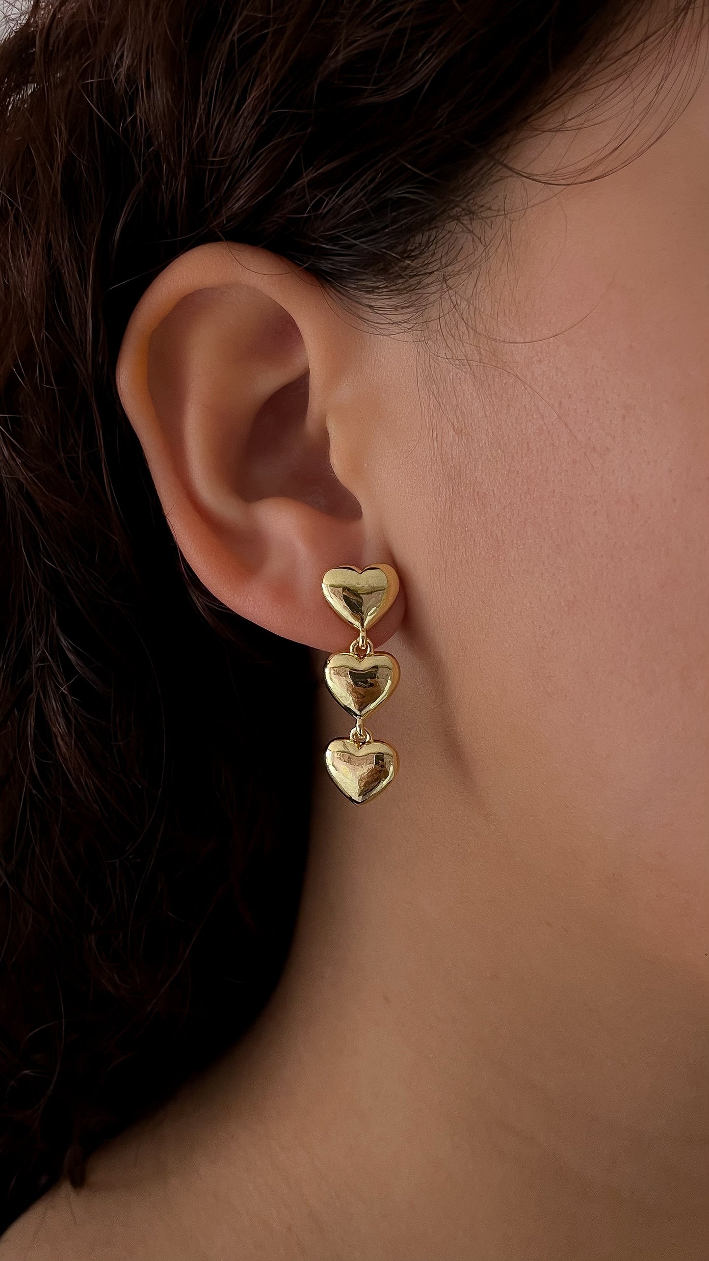 Arete Amores