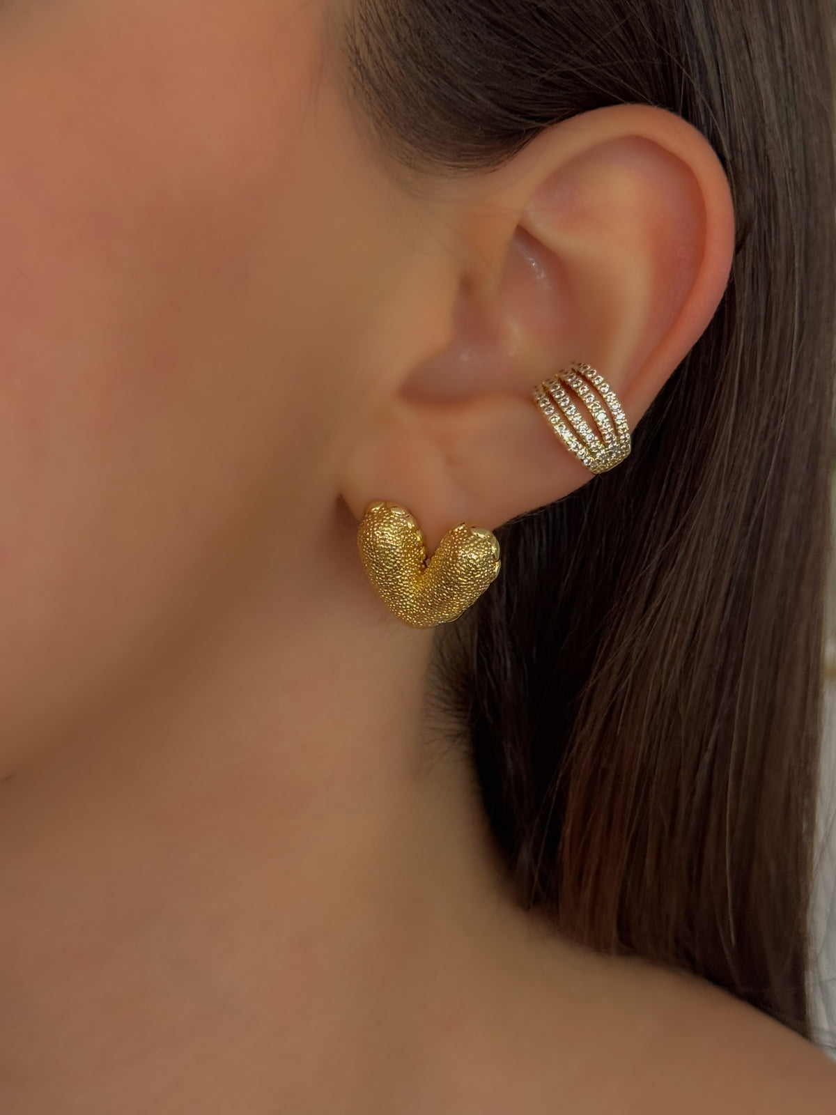 ARETE CORAZON